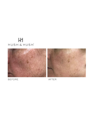 Hush & Hush SkinCapsule BRIGHTEN+ | Skin Care Products | SkinJourney